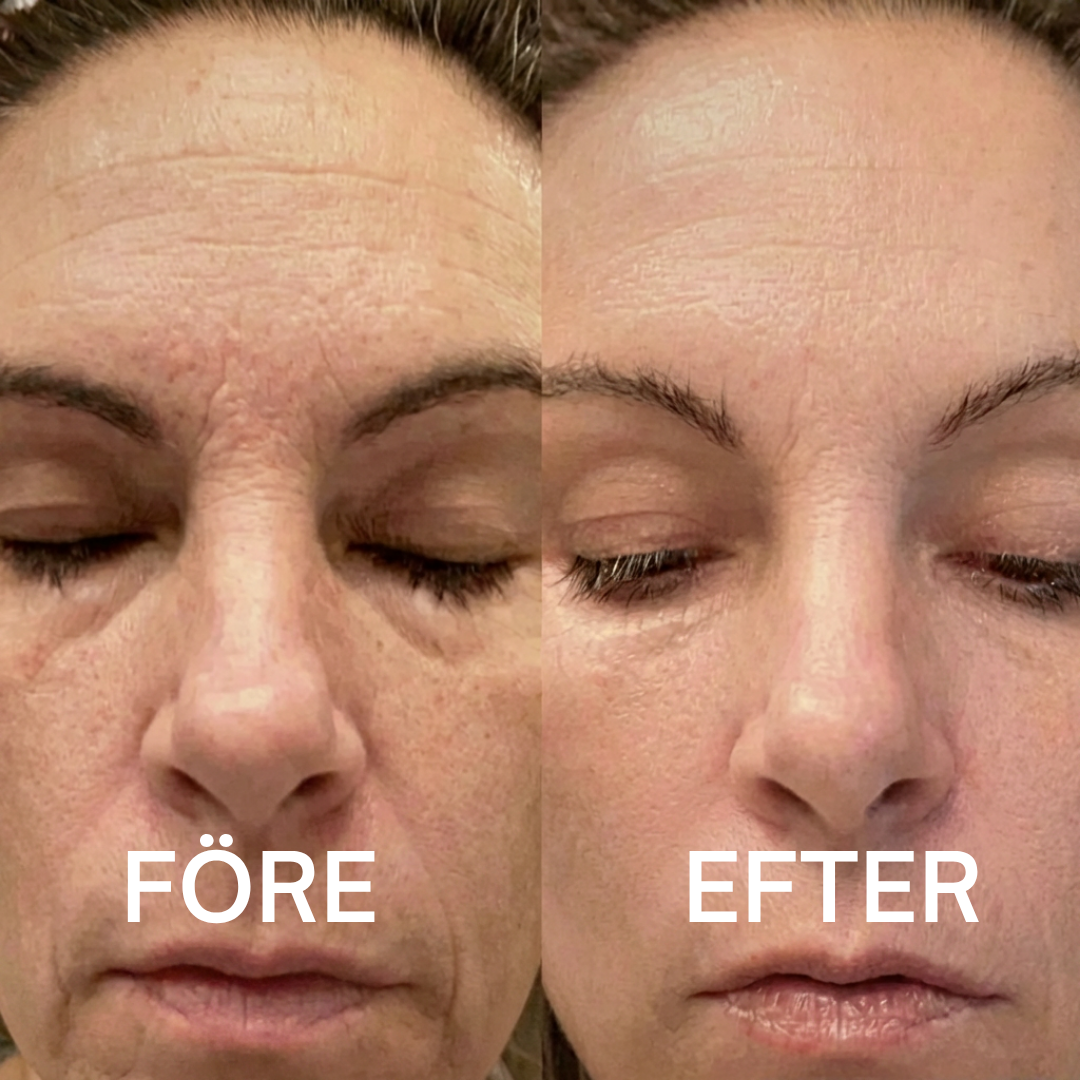 Djupt Återfuktande - Kalcium Balm